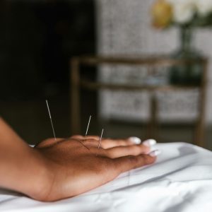 الوخز بالإبر الصينية وهم أم حقيقة
